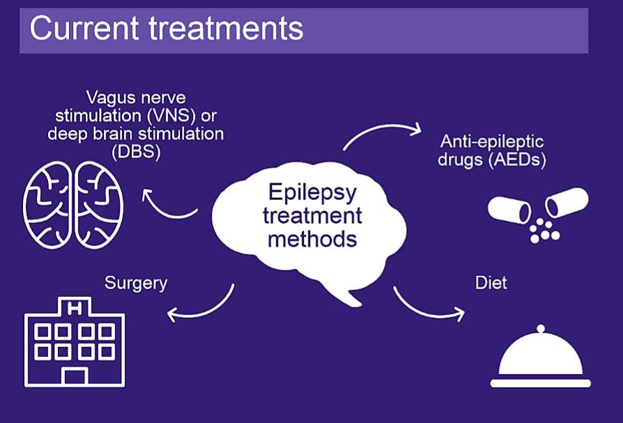 How is epilepsy treated? Neuro Central